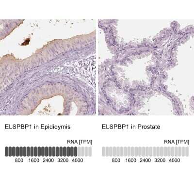 <b>Orthogonal Strategies Validation. </b>Immunohistochemistry-Paraffin: ELSPBP1 Antibody [NBP2-13958] - Analysis in human epididymis and prostate tissues. Corresponding ELSPBP1 RNA-seq data are presented for the same tissues.