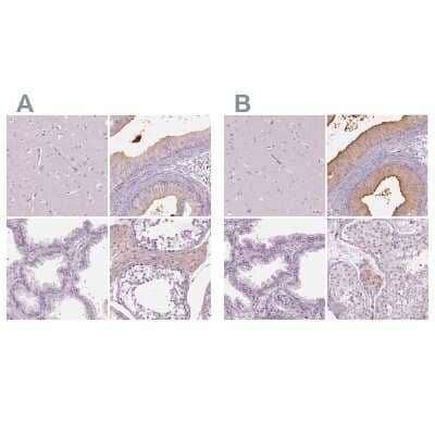 <b>Independent Antibodies Validation. </b>Immunohistochemistry-Paraffin: ELSPBP1 Antibody [NBP2-13958] - Staining of human cerebral cortex, epididymis, prostate and testis using Anti-ELSPBP1 antibody NBP2-13958 (A) shows similar protein distribution across tissues to independent antibody NBP2-13957 (B).