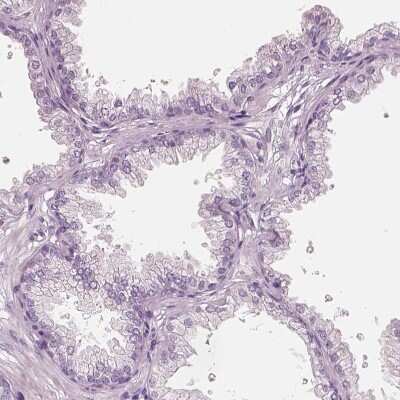 Immunohistochemistry-Paraffin: ELSPBP1 Antibody [NBP2-13958] - Staining of human prostate shows no positivity in glandular cells as expected.