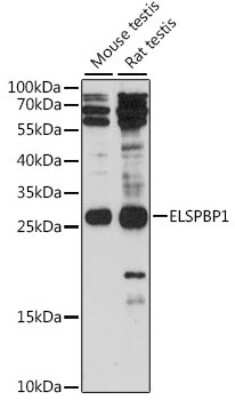 Western Blot: ELSPBP1 Antibody [NBP3-04400] - Analysis of extracts of various cell lines, using ELSPBP1 antibody at 1:1000 dilution. Secondary antibody: HRP Goat Anti-Rabbit IgG (H+L) at 1:10000 dilution. Lysates/proteins: 25ug per lane. Blocking buffer: 3% nonfat dry milk in TBST. Detection: ECL Bas