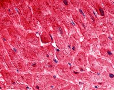 Immunohistochemistry-Paraffin: ELTD1/ETL Antibody [NLS2116] - Analysis of anti-ELTD1 antibody with human heart.