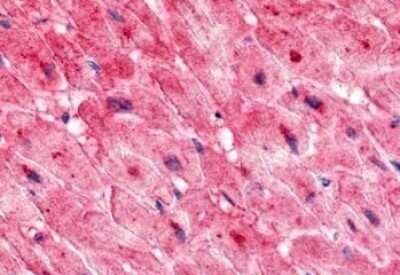Immunohistochemistry-Paraffin: ELTD1/ETL Antibody [NLS2116] - Anti-ELTD1 antibody IHC of human heart. Immunohistochemistry of formalin-fixed, paraffin-embedded tissue after heat-induced antigen retrieval.