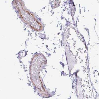 Immunohistochemistry-Paraffin: EMAP-5 Antibody [NBP2-30628] - Staining of human colon shows strong cytoplasmic positivity in endothelial cells.