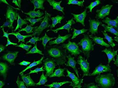 Immunocytochemistry/Immunofluorescence: EMAP-II/AIMP1 Antibody [NBP2-99128] - Immunofluorescence staining of EMAP-II/AIMP1 in HeLa cells. Cells were fixed with 4% PFA, permeabilzed with 0.1% Triton X-100 in PBS, blocked with 10% serum, and incubated with rabbit anti-Human EMAP-II/AIMP1 polyclonal antibody (dilution ratio 1:500) at 4C overnight. Then cells were stained with the Alexa Fluor(R)488-conjugated Goat Anti-rabbit IgG Secondary antibody (green) and counterstained with DAPI (blue).Positive staining was localized to Cytoplasm.