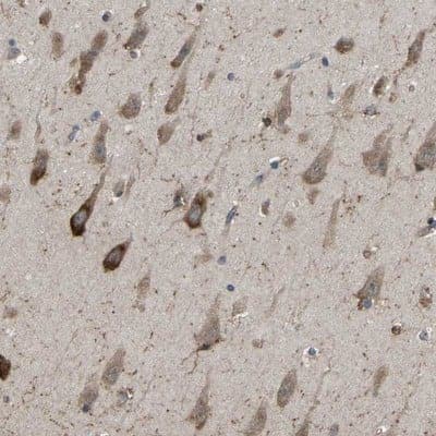 Immunohistochemistry-Paraffin: EMAP-II/AIMP1 Antibody [NBP1-84851] - Staining of human hippocampus shows distinct cytoplasmic positivity in neuronal cells.