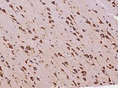 Immunohistochemistry-Paraffin: EMAP-II/AIMP1 Antibody [NBP2-99128] - Staining of human EMAP-II/AIMP1 in human brain with rabbit polyclonal antibody at 1:5000 dilution. 