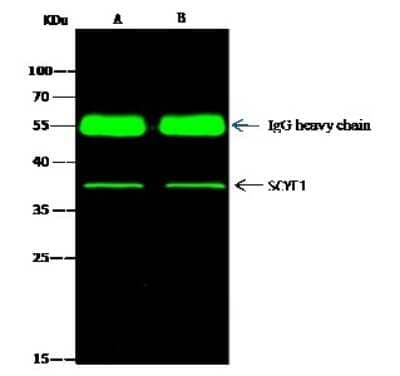 Immunoprecipitation: EMAP-II/AIMP1 Antibody [NBP2-98343] - Mouse EMAP-II/AIMP1 was immunoprecipitated using: Lane A: 0.5 mg HepG2 Whole Cell Lysate. Lane B: 0.5 mg 293T Whole Cell Lysate. 2 ul anti-Mouse EMAP-II/AIMP1 rabbit polyclonal antibody and 15 ul of 50 % Protein G agarose. Primary antibody: Anti-Mouse EMAP-II/AIMP1 rabbit polyclonal antibody, at 1:200 dilution. Secondary antibody: Dylight 800-labeled antibody to rabbit IgG (H+L), at 1:5000 dilution. Developed using the Odyssey technique. Performed under reducing conditions. Predicted band size: 38 kDa. Observed band size: 38 kDa