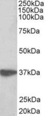 Western Blot: EMAP-II/AIMP1 Antibody [NBP2-26124] - NBP2-26124 (0.3ug/ml) staining of Jurkat lysate (35ug protein in RIPA buffer). Primary incubation was 1 hour. Detected by chemiluminescence.