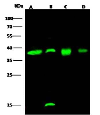 Western Blot: EMAP-II/AIMP1 Antibody [NBP2-98343] - Anti-EMAP-II/AIMP1 rabbit polyclonal antibody at 1:500 dilution. Lane A: Jurkat Whole Cell Lysate. Lane B: Rat brain Tissue Lysate. Lane C: 293T Whole Cell Lysate. Lane D: HepG2 Whole Cell Lysate. Lysates/proteins at 30 ug per lane. Secondary Goat Anti-Rabbit IgG H&L (Dylight 800) at 1/10000 dilution. Developed using the Odyssey technique. Performed under reducing conditions. Predicted band size: 34 kDa. Observed band size: 38 kDa (We are unsure as to the identity of these extra bands).