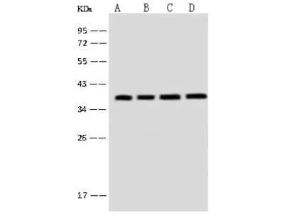 Western Blot: EMAP-II/AIMP1 Antibody [NBP2-99128] - Anti-EMAP-II/AIMP1 rabbit polyclonal antibody at 1:500 dilution. Lane A: H1299 Whole Cell Lysate. Lane B: HepG2 Whole Cell Lysate. Lane C: HEK293 Whole Cell Lysate. Lane D: Jurkat Whole Cell Lysate. Lysates/proteins at 30 ug per lane. Secondary Goat Anti-Rabbit IgG (H+L)/HRP at 1/10000 dilution. Developed using the ECL technique. Performed under reducing conditions. Predicted band size: 34 kDa. Observed band size: 38 kDa