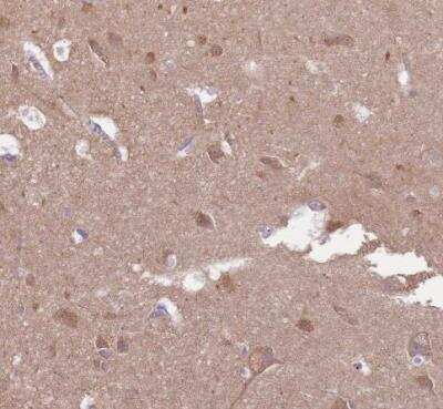 Immunohistochemistry-Paraffin: EMC1 Antibody [NBP2-14151] - Staining of human cerebral cortex shows moderate granular ctyoplasmic positivity in neurons.