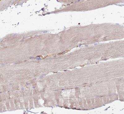 Immunohistochemistry-Paraffin: EMC1 Antibody [NBP2-14151] - Staining of human skeletal muscle shows very weak positivity in myocytes.
