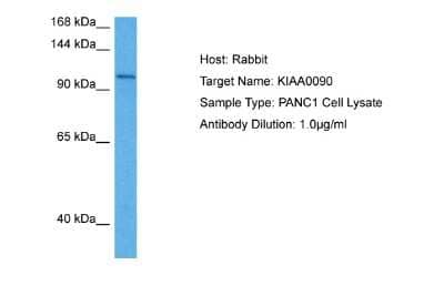 Western Blot: EMC1 Antibody [NBP2-87357] - Host: Rabbit. Target Name: KIAA0090. Sample Tissue: Human PANC1 Whole Cell lysates. Antibody Dilution: 1ug/ml