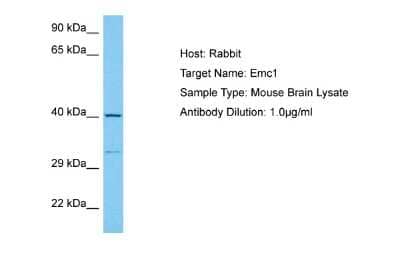 Western Blot: EMC1 Antibody [NBP2-87358] - Host: Rabbit. Target Name: EMC1. Sample Tissue: Mouse Brain lysates. Antibody Dilution: 1ug/ml