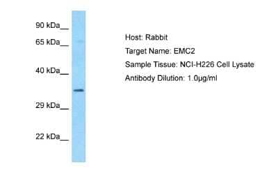 Western Blot: EMC2 Antibody [NBP2-87359] - Host: Rabbit. Target Name: EMC2. Sample Type: NCI-H226 Whole Cell lysates. Antibody Dilution: 1.0ug/ml