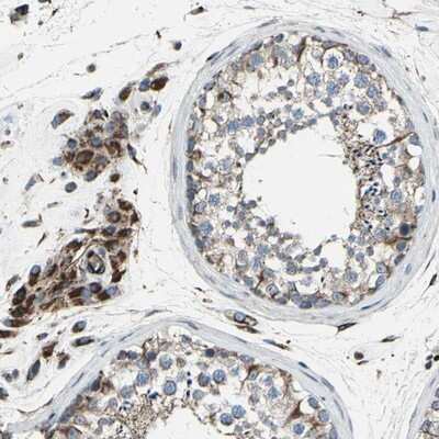 Immunohistochemistry-Paraffin: EMC7 Antibody [NBP1-88547] - Staining of human testis shows strong granular cytoplasmic positivity in leydig cells.