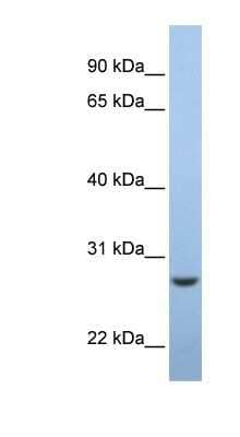 Western Blot: EMC7 Antibody [NBP1-62595] - Human Muscle lysate, concentration 0.2-1 ug/ml.