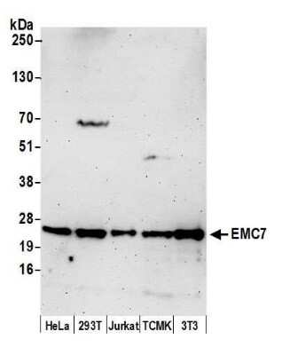 Western Blot: EMC7 Antibody [NBP2-60710] - Detection of human and mouse EMC7 by western blot. Samples: Whole cell lysate (50 ug) from HeLa, 293T, Jurkat, mouse TCMK-1, and mouse NIH3T3 cells prepared using NETN lysis buffer. Antibody: Affinity purified rabbit anti-EMC7 antibody NBP2-60710 used for WB at 1:1000. Detection: Chemiluminescence with an exposure time of 30 seconds.