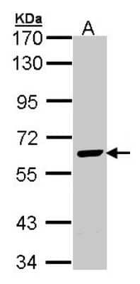 Western Blot: EME1 Antibody [NBP1-32024] - Sample (30 ug of whole cell lysate) A: H1299 7.5% SDS PAGE; antibody diluted at 1:1000.