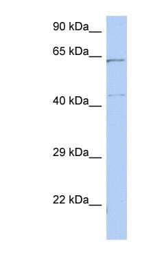 Western Blot: EME1 Antibody [NBP1-55350] - Titration: 0.2-1 ug/ml, Positive Control: HT1080 cell lysate.