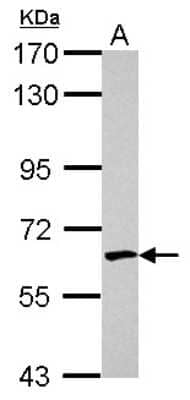 Western Blot: EME1 Antibody [NBP2-16325] - Sample (30 ug of whole cell lysate) A: HeLa 7. 5% SDS PAGE gel, diluted at 1:1000.