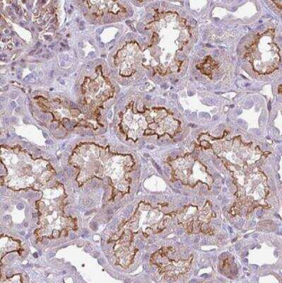Immunohistochemistry-Paraffin: EME2 Antibody [NBP2-30885] - Staining of human kidney shows strong membranous positivity in cells in tubules.