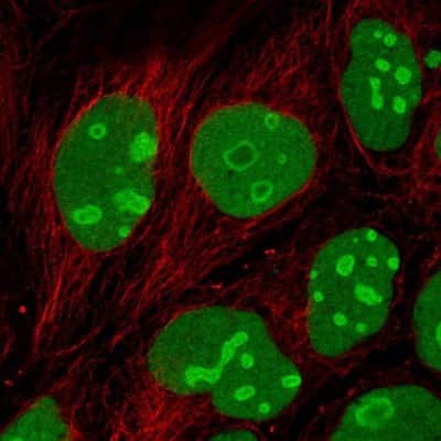Immunocytochemistry/ Immunofluorescence EMG1 Antibody - BSA Free