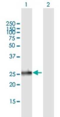 Western Blot: EMG1 Antibody [H00010436-B01P] - Analysis of EMG1 expression in transfected 293T cell line by EMG1 polyclonal antibody.  Lane 1: EMG1 transfected lysate(26.84 KDa). Lane 2: Non-transfected lysate.