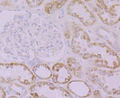 Immunohistochemistry: EMI1 Antibody (JG35-83) [NBP2-76833] - Immunohistochemical analysis of paraffin-embedded human kidney tissue using anti-Emi1 antibody. Counter stained with hematoxylin.