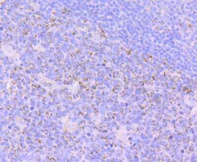 Immunohistochemistry: EMI1 Antibody (JG35-83) [NBP2-76833] - Immunohistochemical analysis of paraffin-embedded human tonsil tissue using anti-Emi1 antibody. Counter stained with hematoxylin.
