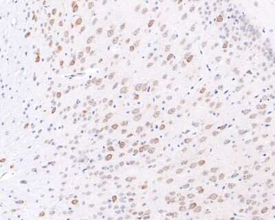 Immunohistochemistry-Paraffin: EMI1 Antibody (JG35-83) [NBP2-76833] - Analysis of paraffin-embedded mouse brain  tissue with Rabbit anti-EMI1 antibody washed with ddH2O and PBS, and then probed with the primary antibody  at 1/400 dilution for 1 hour at room temperature. The detection was performed using an HRP conjugated compact polymer system. DAB was used as the chromogen. Tissues were counterstained with hematoxylin and mounted with DPX.