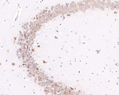 Immunohistochemistry-Paraffin: EMI1 Antibody (JG35-83) [NBP2-76833] - Analysis of paraffin-embedded mouse hippocampus tissue with Rabbit anti-EMI1 antibody washed with ddH2O and PBS, and then probed with the primary antibody  at 1/400 dilution for 1 hour at room temperature. The detection was performed using an HRP conjugated compact polymer system. DAB was used as the chromogen. Tissues were counterstained with hematoxylin and mounted with DPX.
