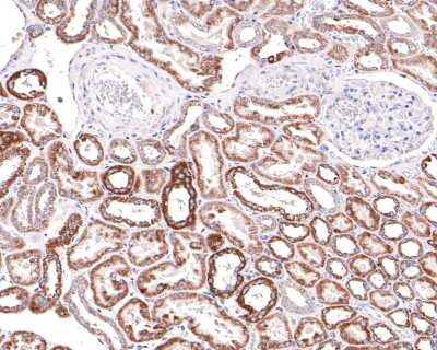 Immunohistochemistry-Paraffin: EMI1 Antibody (JG35-83) [NBP2-76833] - Analysis of paraffin-embedded Human kidney with Rabbit anti-EMI1 antibody washed with ddH2O and PBS, and then probed with the primary antibody  at 1/400 dilution for 1 hour at room temperature. The detection was performed using an HRP conjugated compact polymer system. DAB was used as the chromogen. Tissues were counterstained with hematoxylin and mounted with DPX.