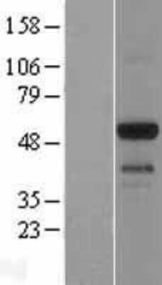 Western Blot: EMID1 Overexpression Lysate (Adult Normal) [NBL1-10255] Left-Empty vector transfected control cell lysate (HEK293 cell lysate); Right -Over-expression Lysate for EMID1.
