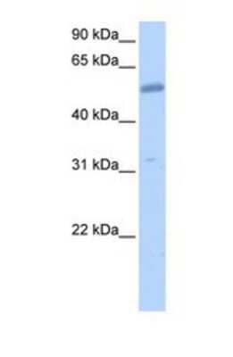 Western Blot: EMID2 Antibody [NBP1-69681] - This Anti-EMID2 antibody was used in Western Blot of 721_B tissue lysate at a concentration of 1ug/ml.