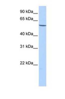 Western Blot: EMID2 Antibody [NBP1-69698] - This Anti-EMID2 antibody was used in Western Blot of HepG2 tissue lysate at a concentration of 1ug/ml.