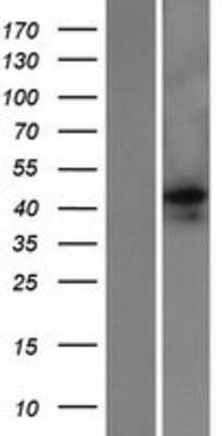 Western Blot: EMID2 Overexpression Lysate (Adult Normal) [NBP2-05699] Left-Empty vector transfected control cell lysate (HEK293 cell lysate); Right -Over-expression Lysate for EMID2.