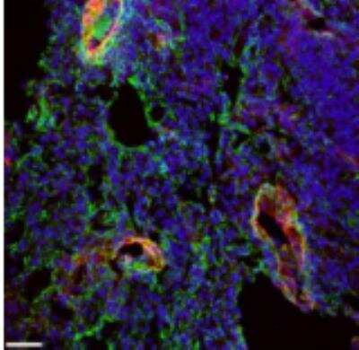 Immunocytochemistry/Immunofluorescence: EMILIN1 Antibody (C11A8) [NBP2-36338] - Positive staining for EMILIN1 (green) in mouse lung tissue is both detected in lung parenchymal fibers and associated with lymphatic vessel structures. Lyve-1 (red) is used as lymphatic vessel marker. Blue, nuclei.Scale bar: 37.00 um