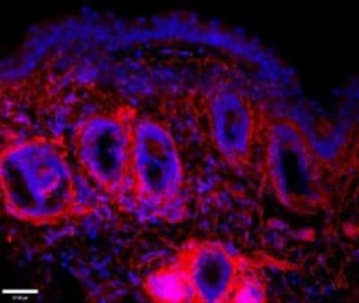 Immunocytochemistry/Immunofluorescence: EMILIN1 Antibody (C11A8) [NBP2-36338] - Positive staining for EMILIN1 (green) in mouse lymph node. In red, lymphatic vessels positive for Lyve-1. Yellow represents the close association of EMILIN1 with lymphatic vessel structures. Scale bar: 37.00 um Positive staining for EMILIN1 (red) in mouse skin. Blue, nuclei; Scale bar: 37.00 um
