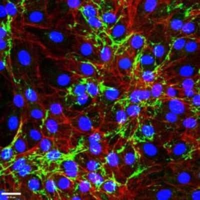 Immunocytochemistry/Immunofluorescence: EMILIN1 Antibody (C11A8) [NBP2-36338] - Positive staining of EMILIN1 (green) in mouse fibroblasts (NIH 3T3).cytoskeleton is stained in red, nuclei in blue. Scale bar 28 um.