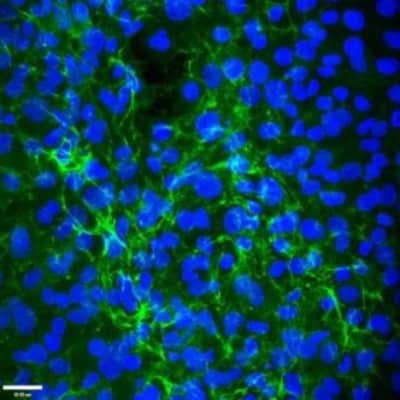 Immunocytochemistry/Immunofluorescence: EMILIN1 Antibody (C11A8) [NBP2-36338] - Positive staining of EMILIN1 (green) in mouse lymphatic endothelial cells (LAEC). Nuclei are stained in blue. Scale bar 38 um.