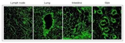 Immunohistochemistry-Frozen: EMILIN1 Antibody (C11A8) [NBP2-36338] - EMILIN1 is expressed in association with lymphatic vessels. Cryostat sections of normal mouse tissues stained with anti-EMILIN1 (green) antibodies. In all mouse tissues and organs examined, EMILIN1 was uniformly distributed in the stroma. In the skin, EMILIN1 staining colocalizes with LYVE-1-positive lymphatic vessels surrounding hair follicles. In the small intestine, EMILIN1 colocalizes with LYVE-1-positive lacteals and submucosal lymphatic vessels. At higher magnification, in the lung and lymph nodes, it is more evident that EMILIN1 is distributed at the abluminal surfaces of LECs . In the lymph node, EMILIN1-positive fibers connecting LECs to the surrounding ECM are evident.