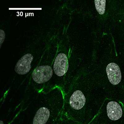 Immunocytochemistry/Immunofluorescence: EMILIN1 Antibody [NBP1-84127] - Human periodontal ligament cells stained with anti-emilin1 (1:300) and goat anti-rabbit Alexa Fluor 488 (1:500). Nuclei costained with 300nM DAPI. ICC/IF image submitted by a verified customer review.