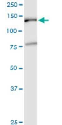 Western Blot: EMILIN2 Antibody (3D9) [H00084034-M01] - EMILIN2 monoclonal antibody (M01), clone 3D9. Analysis of EMILIN2 expression in human colon.