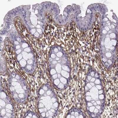 Immunohistochemistry-Paraffin EMILIN2 Antibody