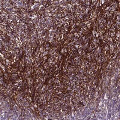 Immunohistochemistry: EMILIN3 Antibody [NBP2-49308] - Staining of human ovary shows strong positivity in ovarian stroma cells.