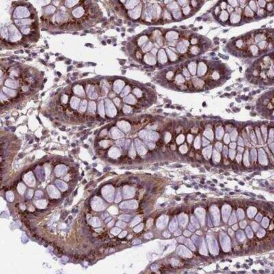 Immunohistochemistry-Paraffin: EMILIN3 Antibody [NBP2-14534] - Staining of human colon shows strong cytoplasmic positivity in glandular cells.
