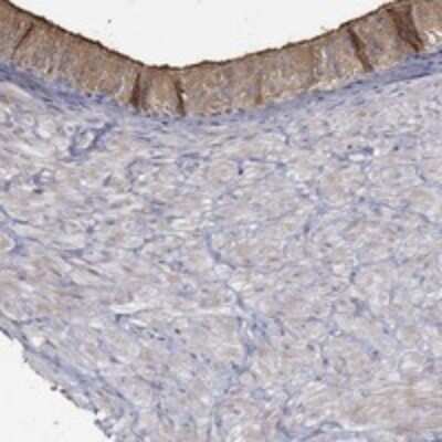 Immunohistochemistry-Paraffin: EMILIN3 Antibody [NBP3-17360] - Staining of human epididymis shows strong cytoplasmic and membranous positivity in glandular cells.