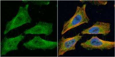 Immunocytochemistry/Immunofluorescence: EML1 Antibody [NBP1-30956] - EML1 antibody [c3], c-term detects EML1 protein at cytoplasm by immunofluorescent analysis.Sample: HeLa cells were fixed in 4% paraformaldehyde at RT for 15 min.Green: EML1 protein stained by EML1 antibody [c3], c-term (NBP1-30956).Red: alpha Tubulin, a cytoskeleton marker, stained by alpha Tubulin antibody [GT114].Blue: Hoechst 33342 staining.