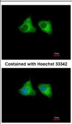 Immunocytochemistry/Immunofluorescence: EML1 Antibody [NBP2-16327] - Immunofluorescence analysis of methanol-fixed A549, using antibody at 1:500 dilution.